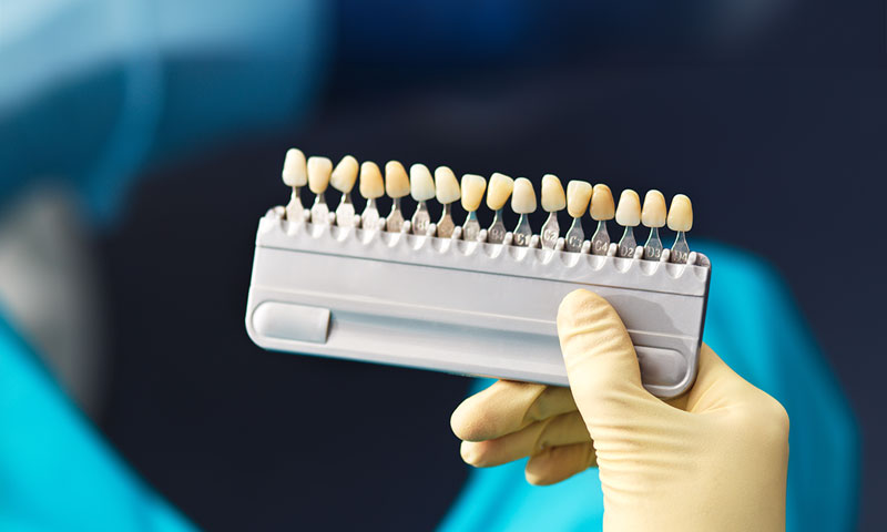 Top-down photo of a doctor holding a set of different colored tooth crowns; blurred background