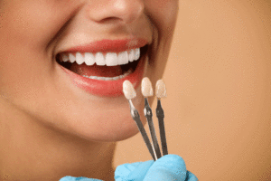 Doctor checking young woman's teeth color on beige background, closeup. Dental veneers.